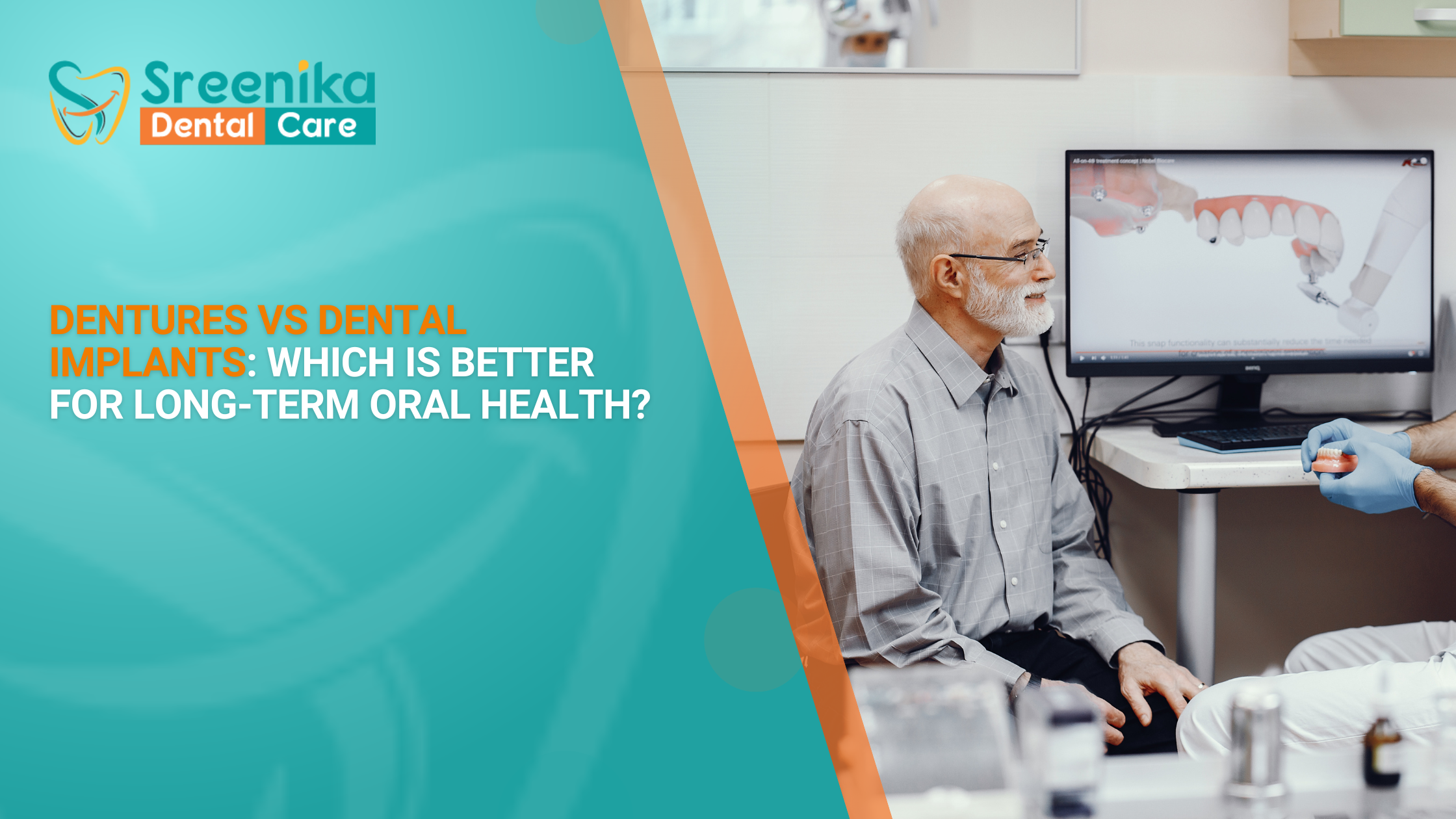 Dentures vs Dental Implants