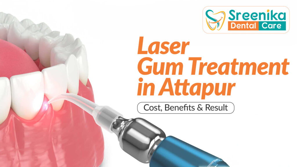 Laser Gum Treatment in Attapur | Sreenika Dental Care